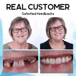 Maldirnagi™ Premium Custom Silicone Denture Set